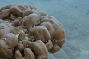 Read more about the article Gut Dysbiosis Symptoms: Understanding the Imbalance