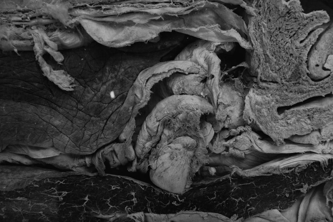 Read more about the article The Gut Lining: What It Does, Why It Breaks Down, and How to Repair It