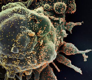 Read more about the article Gut and Immune System Connection: What 70% Means